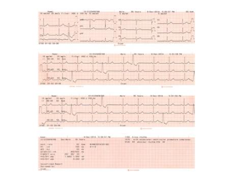 EKG papir til ECG-3150 cardiofax