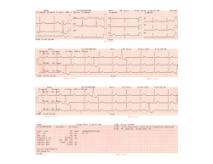 EKG papir til ECG-3150 cardiofax