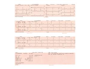 EKG papir til ECG-3150 cardiofax