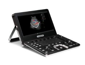 Ultralydsapparat Vinno A5