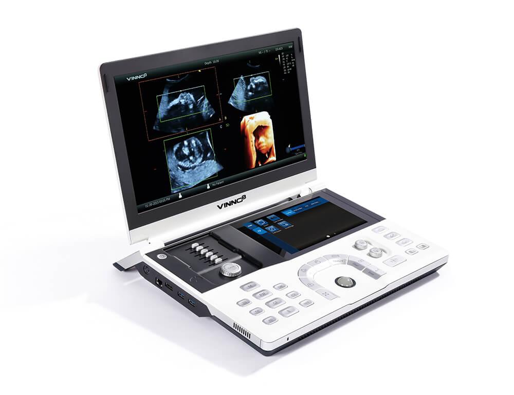 Ultralydsapparat Vinno 6