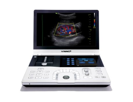 Ultralydsapparat Vinno 6