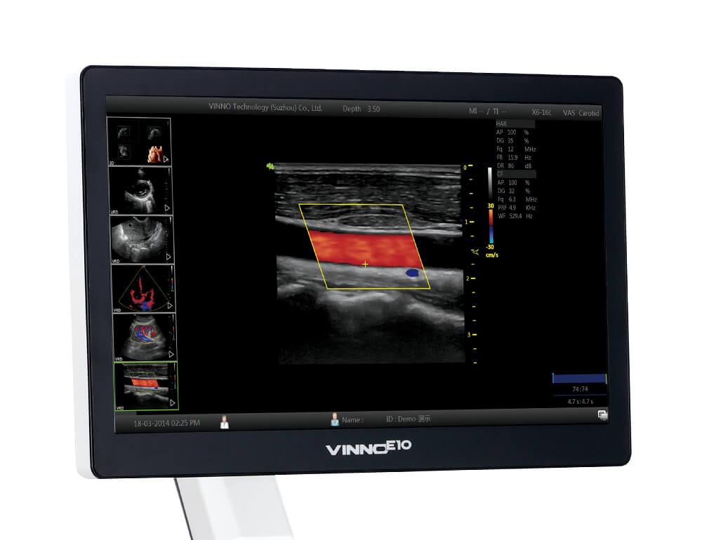 Ultralydsapparat Vinno E10P