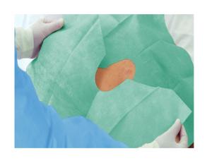 Sterile hulstykker m/ klæb, 45 x 75 cm