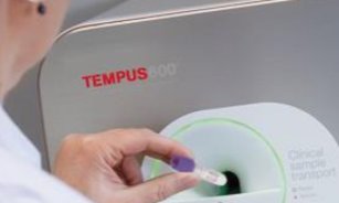 Tempus600 - Hurtigt transportsystem til kritiske blodprøver